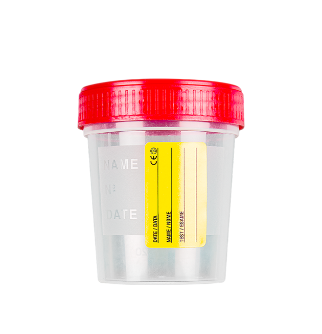 Urine containers Urine containers